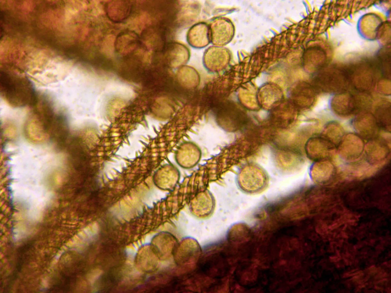 Microscopía de Metatrichia horrida - 10 - Capilicio 3